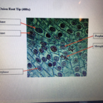 Mitosis Stages Under Microscope Labeled Micropedia