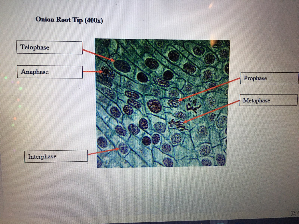 Mitosis Stages Under Microscope Labeled Micropedia